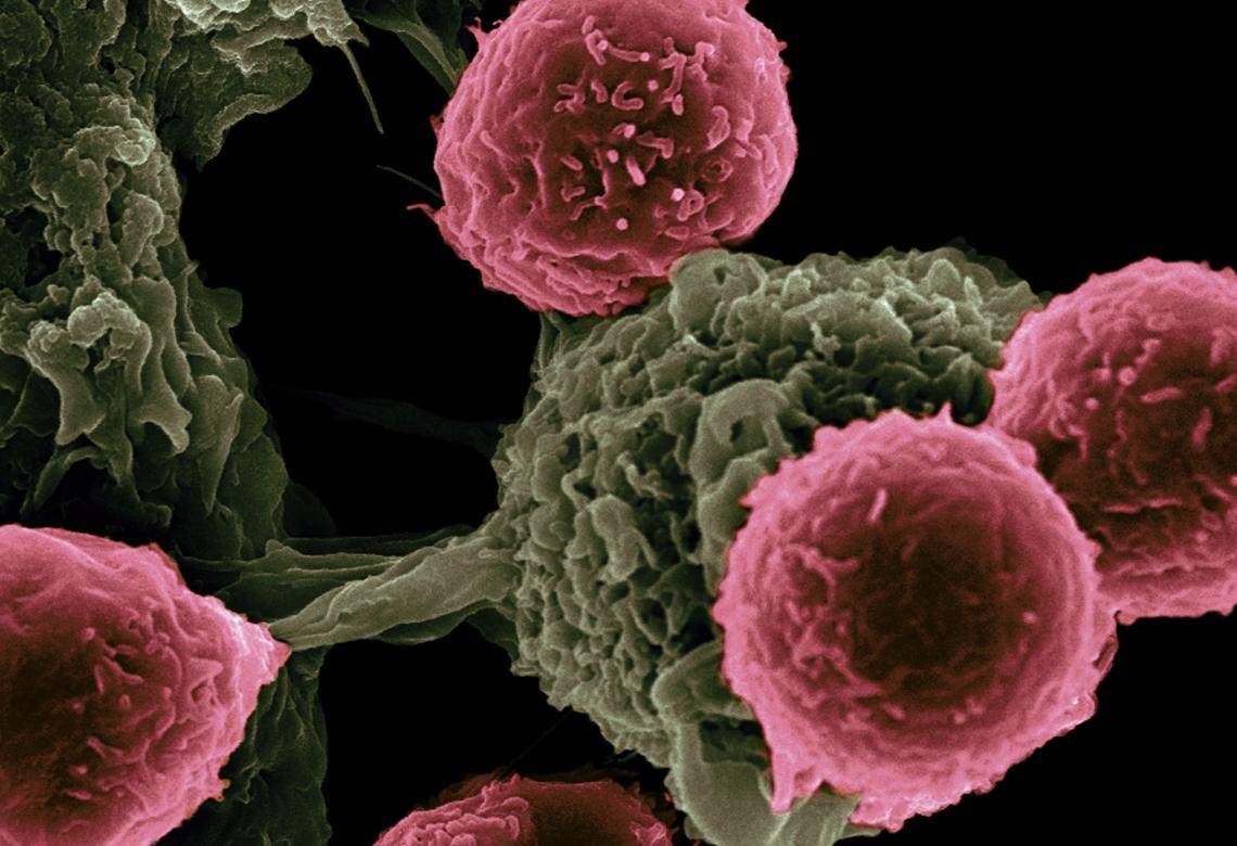 Cancer cells