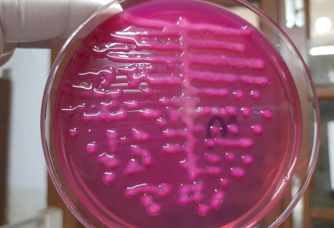 Klebsiella growth on MacConkey agar