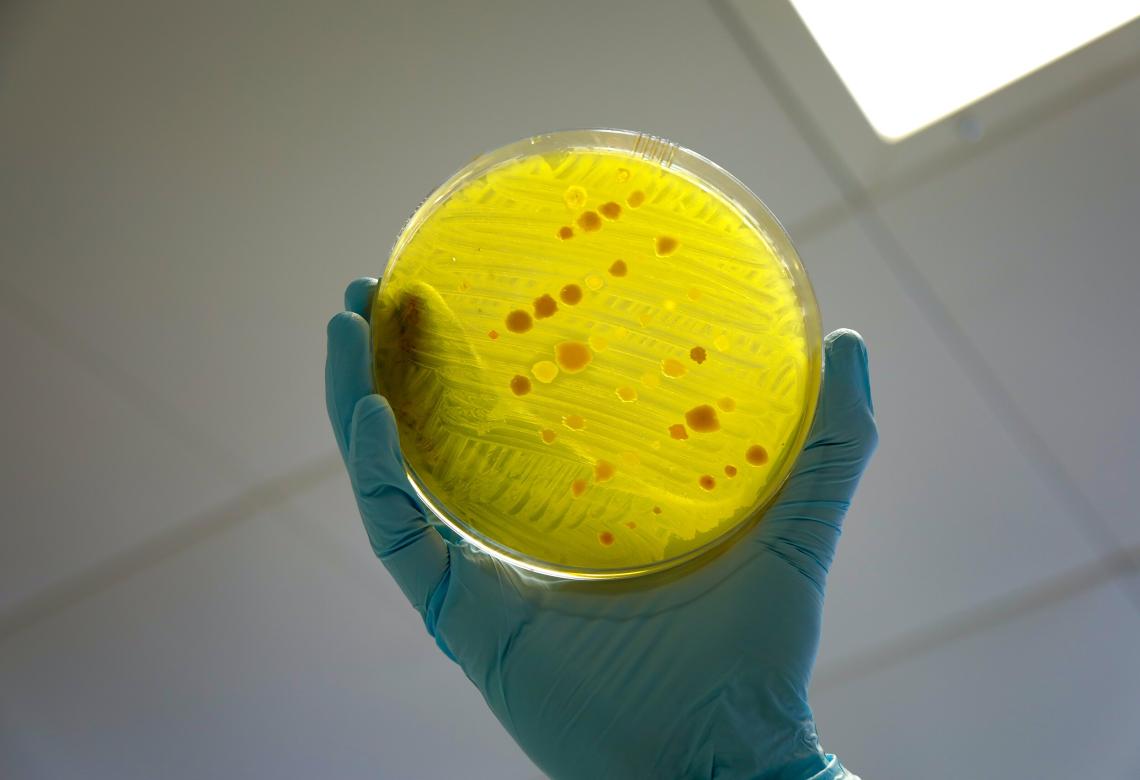 Antimicrobial resistance