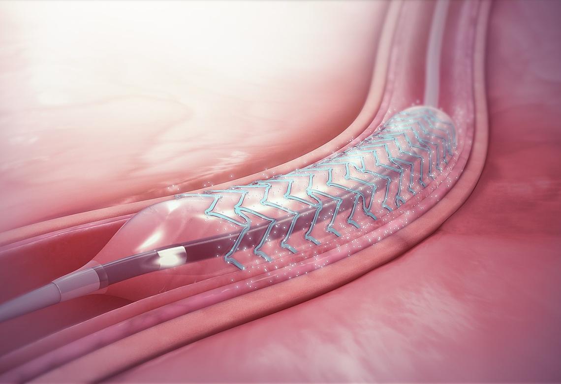 Drug-eluting stent
