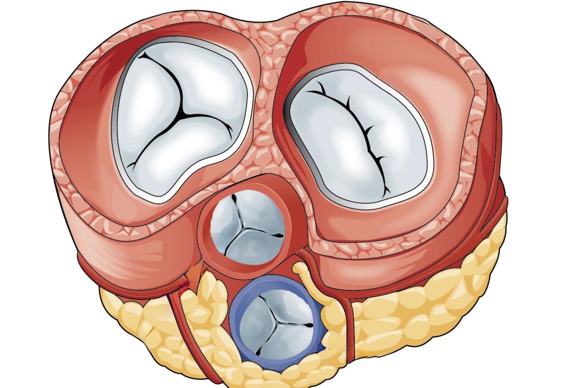 2011 Heart Valves