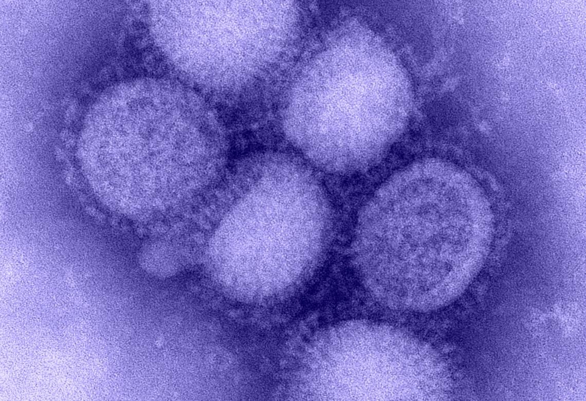 H1N1 influenza virus