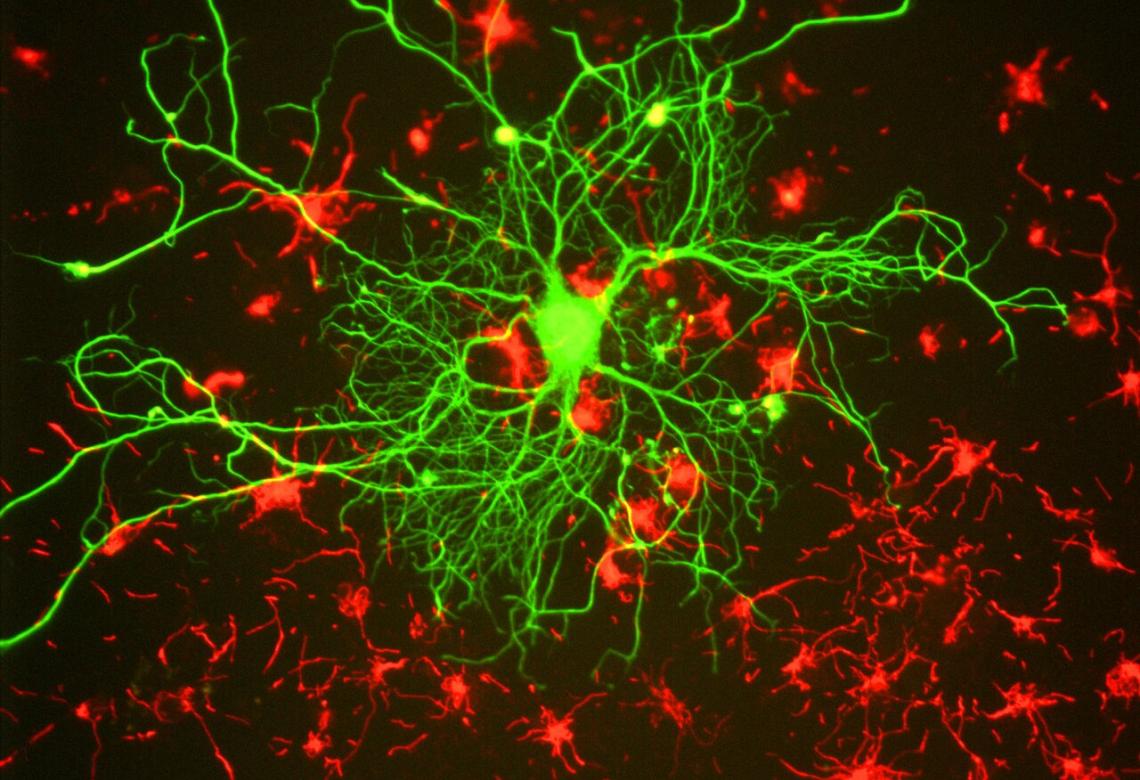 Neuron in tissue culture