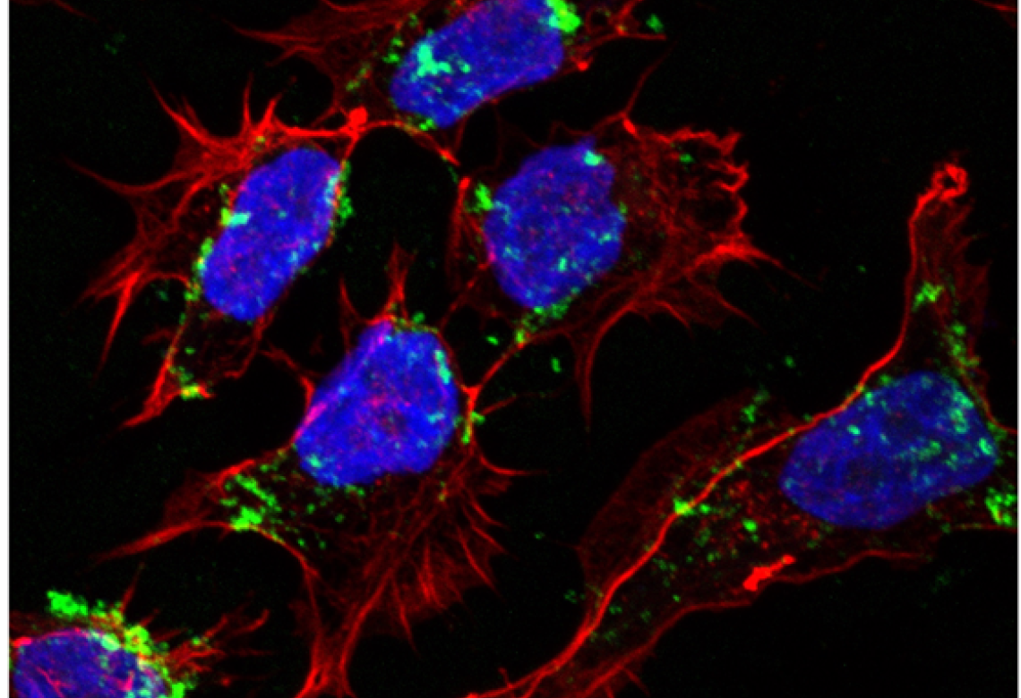 Cnr medulloblastoma