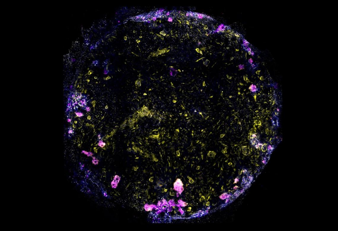 Image of the lung-on-chip, with cell nuclei in blue, macrophage in magenta, endothelial cells in yellow and tight junctions between epithelial and endothelial cells in white