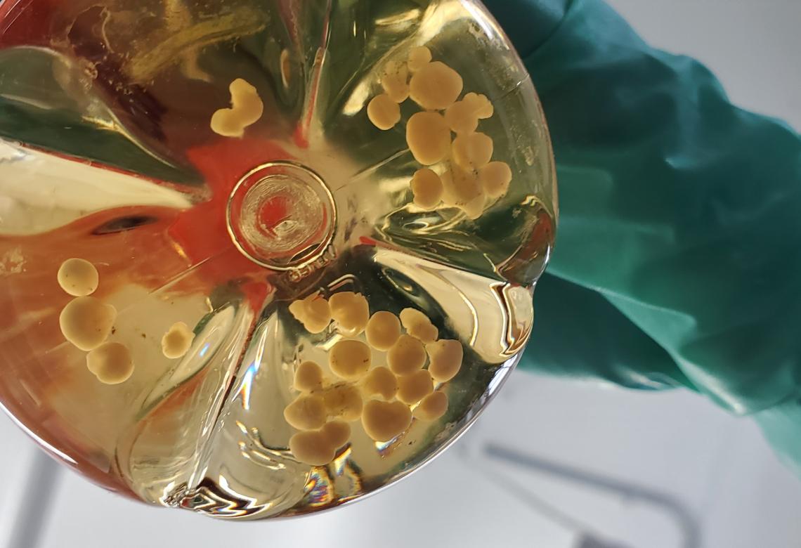 Human Cerebral Organoids